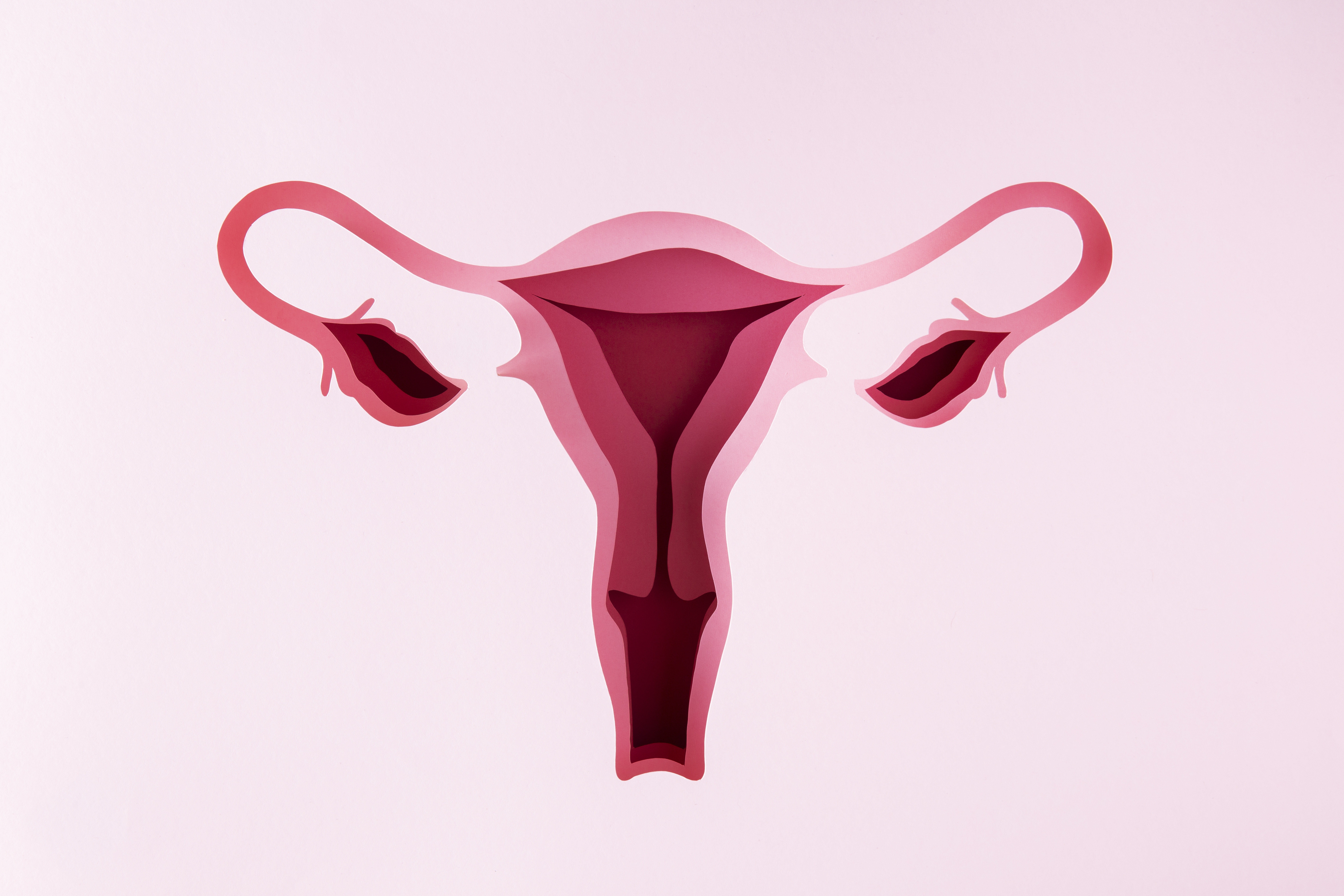Inversio Uterus